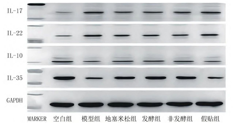 空白组和支气管哮喘各组大鼠肺组织中IL－17、IL－22、IL－10、IL－35蛋白表达电泳图